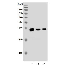 Western blot testing of 1) rat brain, 2) rat kidney and 3) mouse kidney tissue lysate with Aquaporin