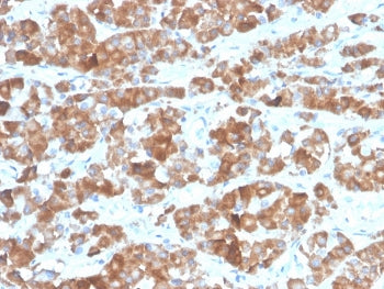 IHC staining of FFPE human pituitary tissue with recombinant Luteinizing Hormone beta antibody (clon