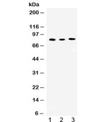 Western blot testing of 1) rat kidney, 2) mouse spleen and 3) human Jurkat lysate with Cyclin T1 ant