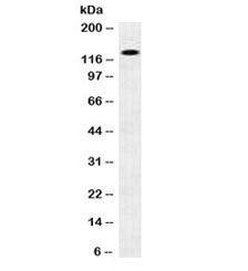 Western blot testing of human brain lysate with N-Cadherin antibody. Predicted molecular weight ~100
