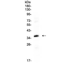CRX Antibody (Cone-rod homeobox)