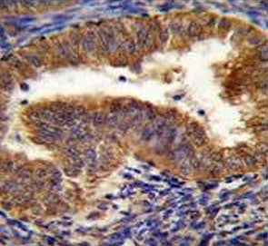 Nix Antibody / BNIP3L