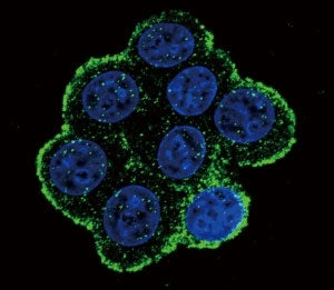 BMPR1A Antibody (ALK3)