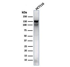 MSH6 Antibody