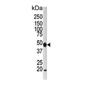 ATG4B Antibody
