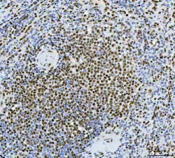 Exonuclease 1 Antibody / EXO1