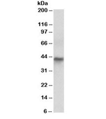 Cytokeratin 19 Antibody