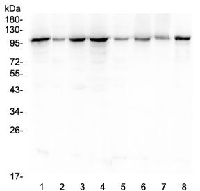 Western blot testing of human 1) HeLa, 2) placenta, 3) COLO-320, 4) SGC-7901, 5) HepG2, 6) K562, 7) 