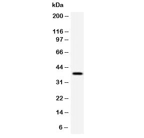 Western blot testing of human HeLa cell lysate with RPSA antibody (clone LMNR-1). Routinely observed