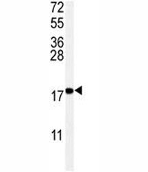 UBC9 Antibody