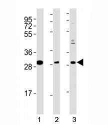 Western blot testing of Nkx2.5 antibody at 1:2000 dilution and mouse tissue; Lane 1: stomach lysate;