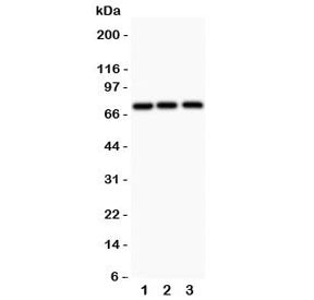 Western blot testing of APLP1 antibody and 1) human HeLa, 2) rat PC-12, and 3) mouse HEPA1-6 lysate;
