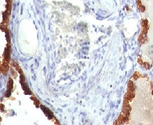 KRT7 Antibody / Cytokeratin 7