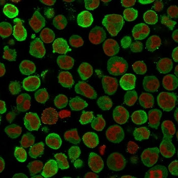Immunofluorescent staining of PFA-fixed human K562 cells with Calponin antibody (clone SPM169, green