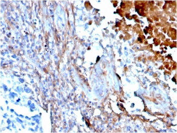 FN1 Antibody / Fibronectin
