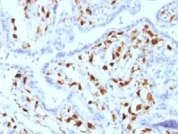 IHC testing of FFPE human placenta with Factor XIIIa antibody (clone SPM180). Required HIER: boil ti