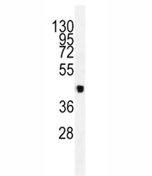 VEGFC Antibody