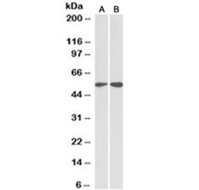 Western blot testing of HeLa [A] and Jurkat [B] lysates with Vimentin antibody at 2ug/ml. Predicted 