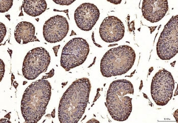 TBK1 Antibody
