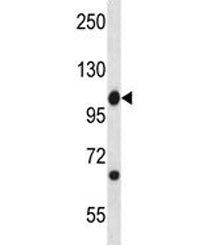 Abl1 antibody western blot analysis in mouse spleen tissue lysate. Predicted molecular weight ~122 k