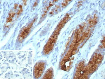 IHC staining of FFPE human stomach tissue with recombinant Mucin 5AC antibody (clone MUC5AC/7066R). 