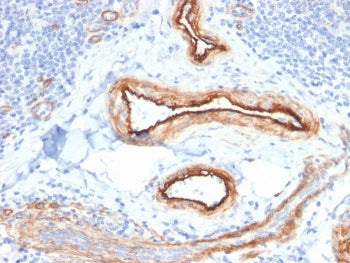MTF1 Antibody / Metal regulatory transcription factor 1