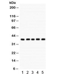 Western blot testing of human 1) MCF7, 2) HeLa, 3) A549, 4) HepG2 and 293 cell lysate with Cdk7 anti