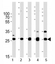Sdhb antibody western blot analysis in human 1) HeLa, 2) HL-60, 3) mouse heart, 4) rat heart, and 5)