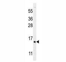 hCG1995004 antibody western blot analysis in Y79 lysate.