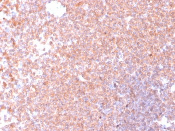IHC staining of FFPE human spleen tissue with RETN antibody (clone RETN/4326). HIER: boil tissue sec