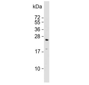 RAB3A Antibody