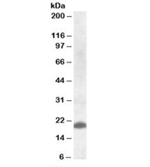 Western blot testing of human spleen lysate with CLEC4C antibody at 1ug/ml. Predicted molecular weig