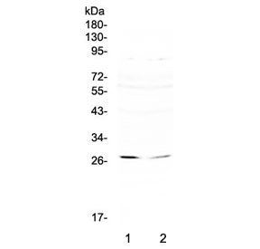 Western blot testing of 1) human SW620 and 2) human HepG2 cell lysate with RNF186 antibody at 0.5ug/