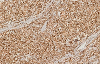 PMS2 Antibody / Post Meiotic Segregation Increased 2