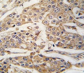 Pyruvate Kinase Antibody / PKM2