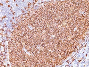 IHC testing of CD20 antibody and FFPE human tonsil tissue. HIER: boil tissue sections in pH 9 10mM T