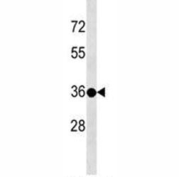 TSPY3 Antibody