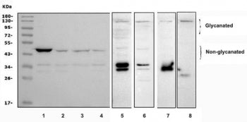 Western blot testing testing of human 1) MCF-7, 2) HeLa, 3) HepG2, 4) SW620, 5) rat brain, 6) rat PC