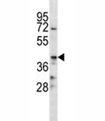 CD86 Antibody