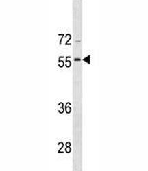 BMP8A Antibody