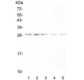 Western blot testing of 1) human PANC-1, 2) human SGC-7901, 3) human A549, 4) rat testis and 5) mous