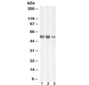 Alkaline Phosphatase Antibody (tissue-nonspecific)