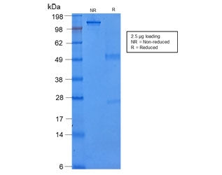 SDS-PAGE analysis of purified, BSA-free recombinant CK8 antibody (clone rB22.1) as confirmation of i