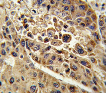 KMO Antibody / Kynurenine 3 monooxygenase