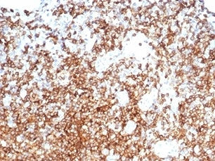 CD13 Antibody / ANPEP