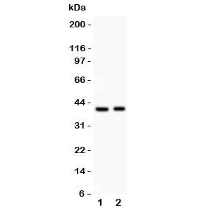 IRF4 Antibody (MUM1)
