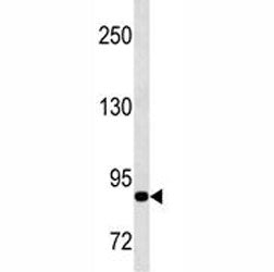 MMP9 Antibody