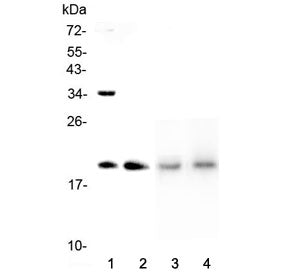 Dermatopontin Antibody