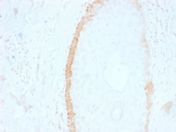 IHC testing of FFPE human skin with Cytokeratin 15 antibody (clone SPM190). Required HIER: boil tiss
