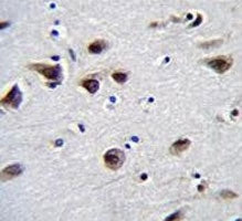 MeCP2 antibody immunohistochemistry analysis in formalin fixed and paraffin embedded human brain tis